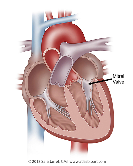 Mitral Valve Anatomy